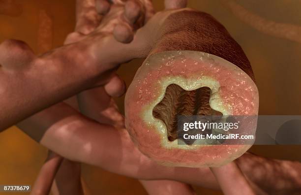 bronchiole - smooth muscle stock illustrations