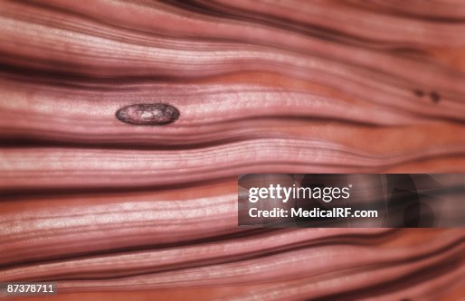 Dense regular connective tissue Dense regular connective tissue