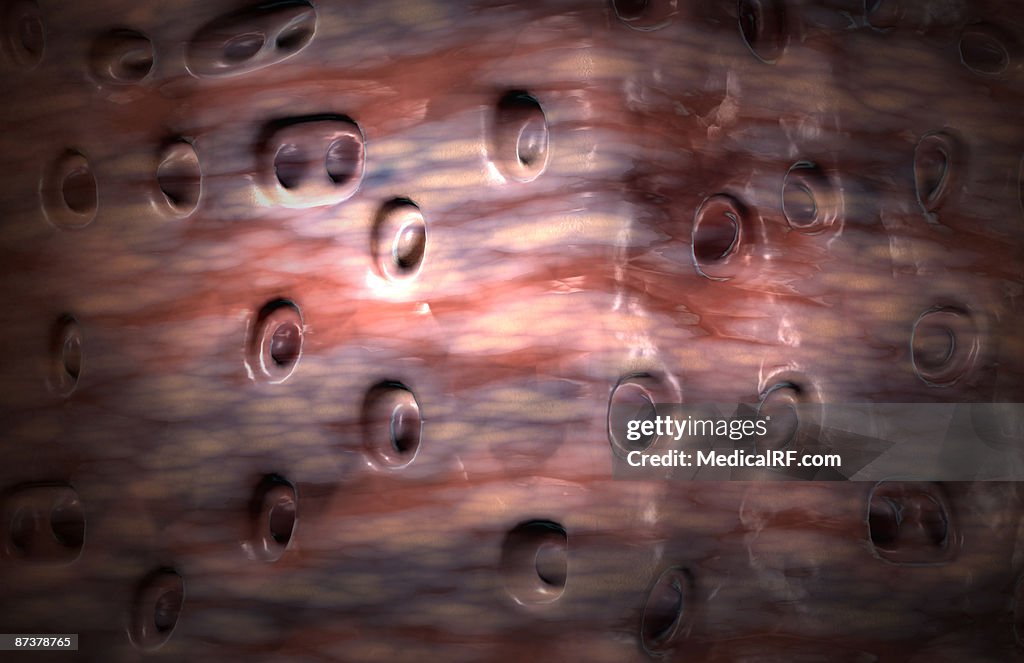 Fibrocartilage