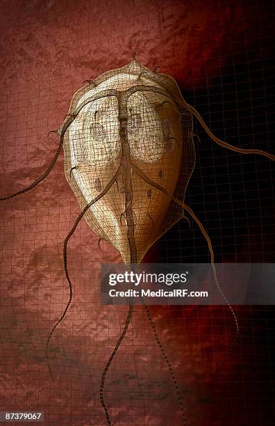 giardiasis - gastroenteritis stock illustrations