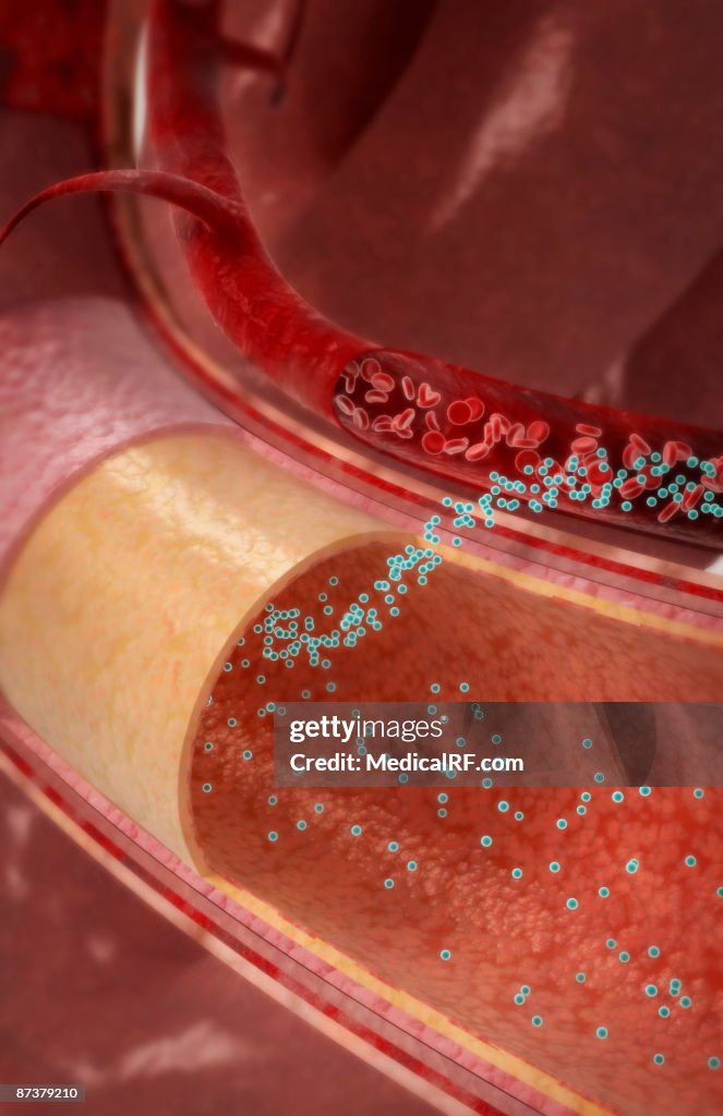 Absorb Medication Drug Absorption High-Res Vector Graphic - Getty Images
