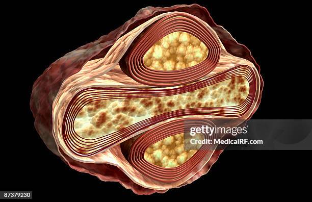Smallpox Organs Smallpox Illustration Photos and Premium High Res Pictures - Getty Images