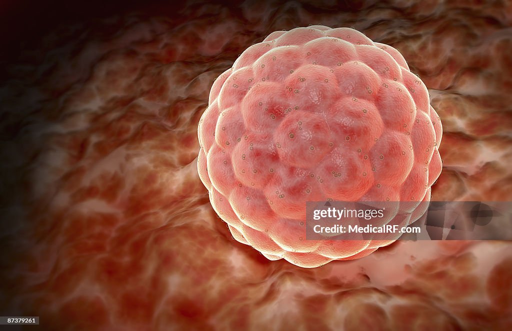 Implantation