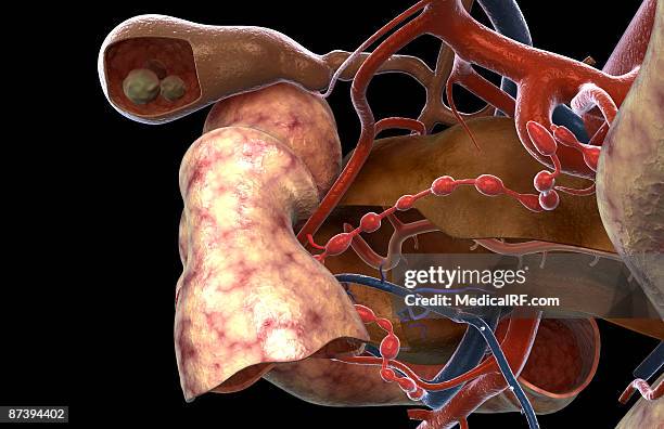 gallstones - gall stone stock illustrations