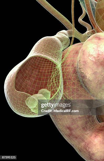 gallstones - gall stone stock illustrations