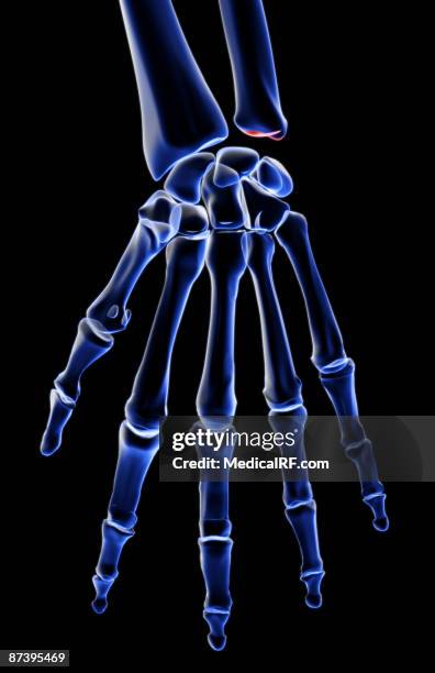 Navigular Hand 156 Navicular Bone Of Hand Stock Photos, High-Res Pictures, and Images ...