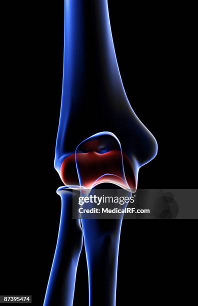 Condyle Pin Elbow Lateral Condyle Photos and Premium High Res Pictures - Getty Images