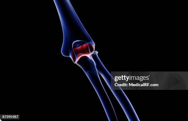Condyle Pin Elbow 71 Lateral Condyle Stock Photos, High-Res Pictures, and Images - Getty ...