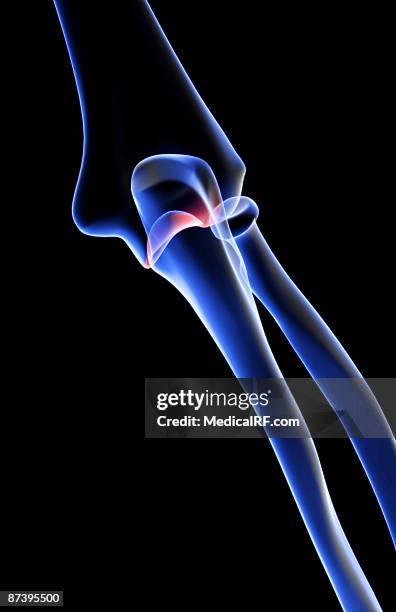 Condyle Pin Elbow 71 Lateral Condyle Stock Photos, High-Res Pictures, and Images - Getty ...