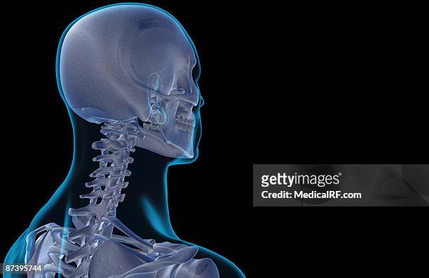 Occipital Bone Photos and Premium High Res Pictures - Getty Images