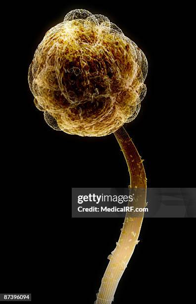 Stachybotrys Musae Stachybotrys Alternans Photos and Premium High Res Pictures - Getty Images