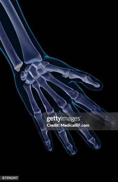 Navigular Hand Navicular Bone Of Hand Fotografías e imágenes de stock - Getty Images