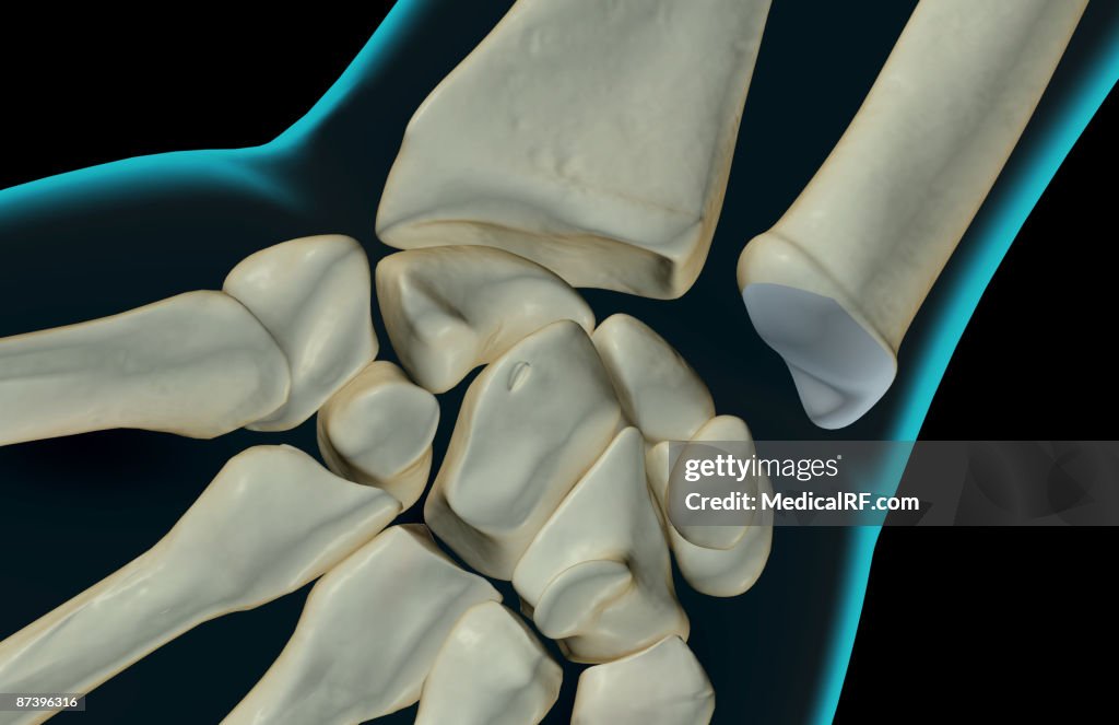 The bones of the wrist