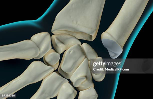 the bones of the wrist - lunares stock illustrations