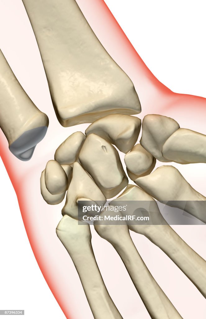 The bones of the wrist