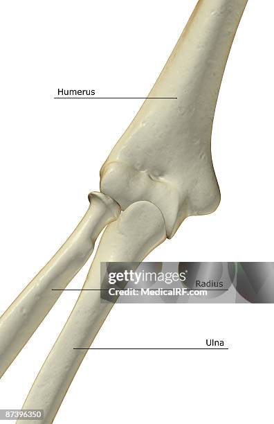 Condyle Pin Elbow Lateral Condyle Photos and Premium High Res Pictures - Getty Images