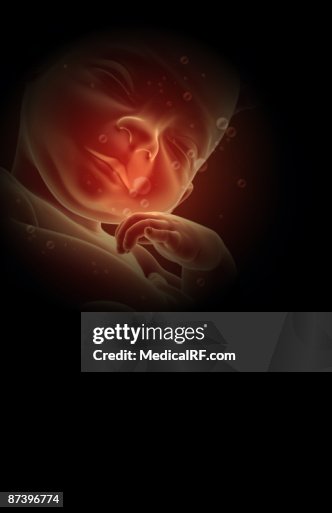Fetus Fetus