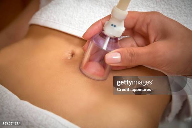 woman getting cellulite vacuum therapy on abdomen - cellulite concept stock pictures, royalty-free photos & images