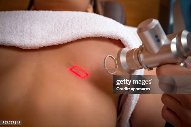 scar reduction laser treatment on young woman breast - fat massage stock pictures, royalty-free photos & images