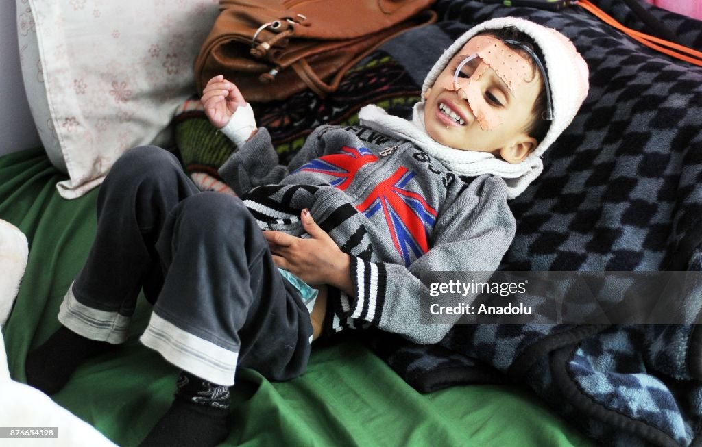 Children in Yemen continue to suffer on Universal Children's Day 