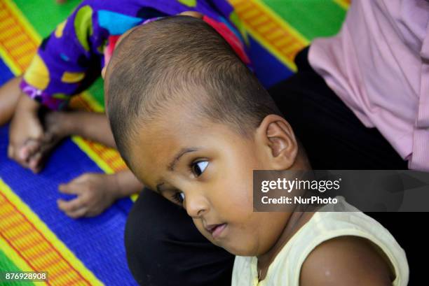 Conjoined twin girls Rabeya Islam and Rokeya Islam play at a Dhaka Medical Collage Hospital in Dhaka, Bangladesh on November 21, 2017. Taslima...