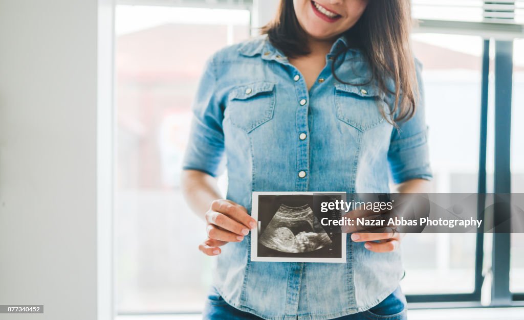 Woman with pregnancy scan in her hand.