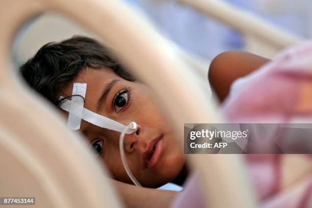 Yemeni child suffering from diphtheria receives treatment at a hospital in the capital Sanaa on November 22, 2017. The United Nations has warned that...