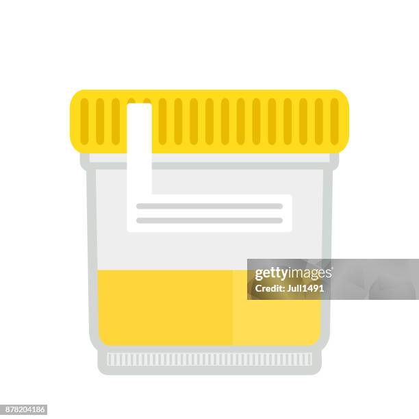 urine test in a plastic jar. - urine sample stock illustrations