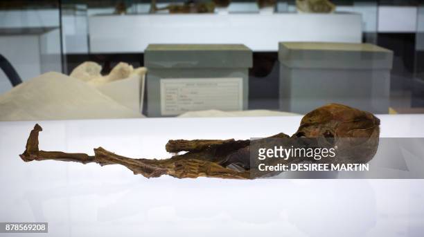 Mummified fetus of 4 or 5 months of intrauterine life traced back to northern Chile is prepared to be displayed at the "Athanatos. Immortal. Death...