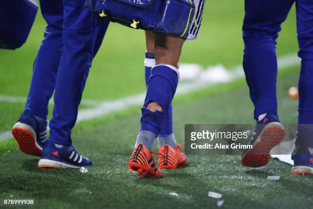 Amine Harit of Schalke has to leave the match injured with his sock torn apart during the Bundesliga match between Borussia Dortmund and FC Schalke...