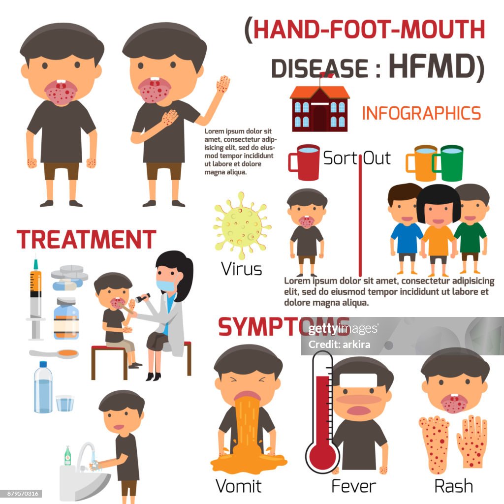Hfmd Hfmd Children Infected Poster Detail Of Handfootmouth Disease ...
