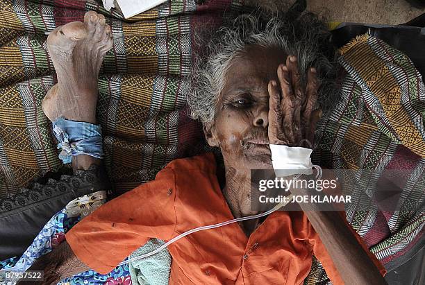 Patients are seen resting at a makeshift hospital for internally displaced Sri Lankan people during a visit by United Nations Secretary-General Ban...