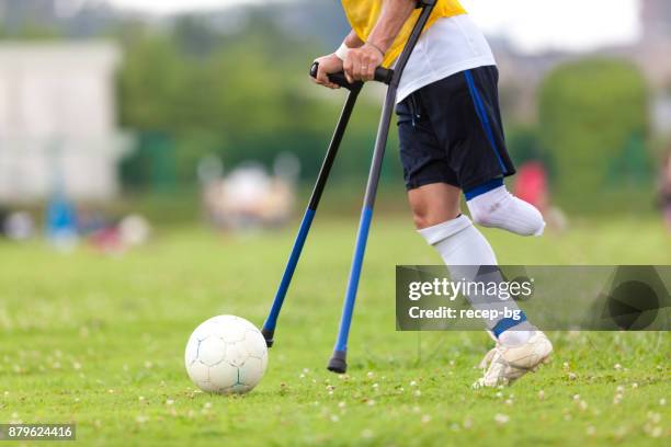 Jugador de fútbol de amputados pateando la bola