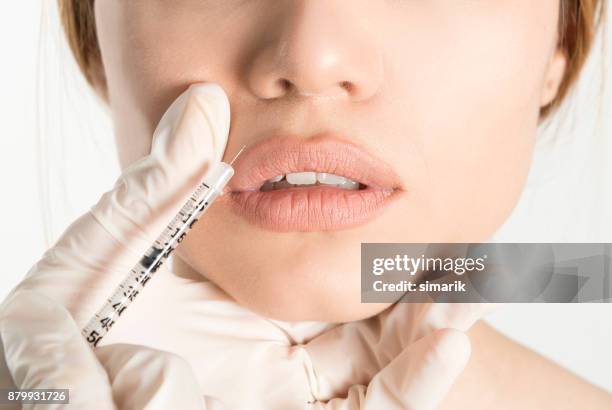 iniezione di botox - chirurgia estetica donna foto e immagini stock