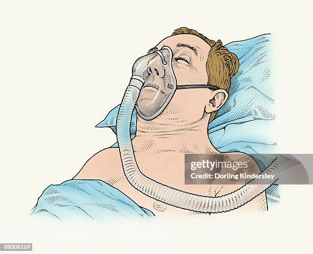 a sleep apnea patient with mask on - patient lying on back stock illustrations