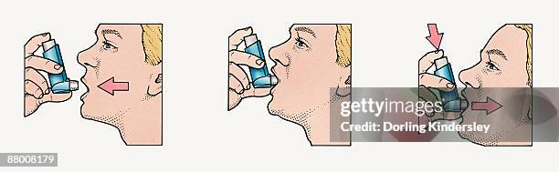 using an asthma inhaler, three steps - inhaler stock illustrations