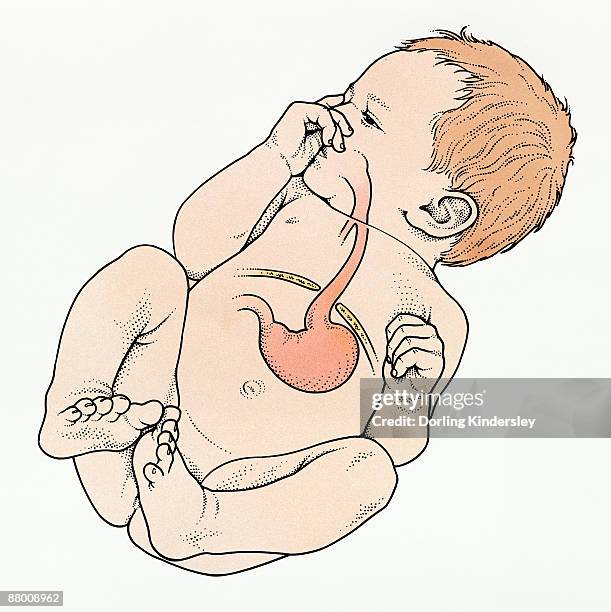 digital illustration of baby showing hiatal hernia of upper part of stomach - medical illustration stock illustrations