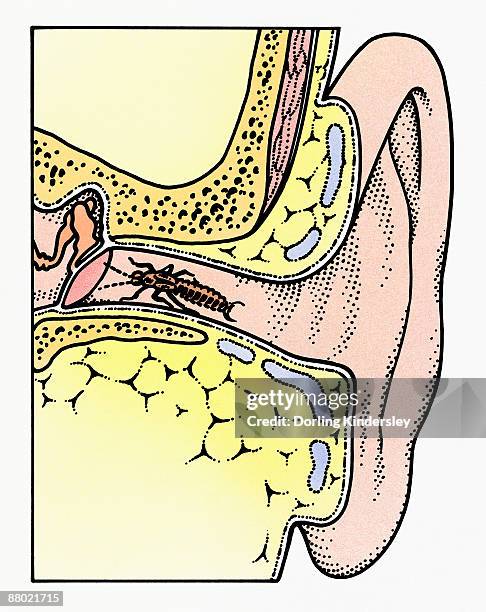 ilustrações de stock, clip art, desenhos animados e ícones de cross section illustration of common earwig (forficula auricularia) in auditory canal of ear, touching tympanic membrane with antennae - earwig