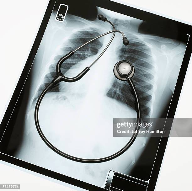 X Ray Frame Xray Frame Photos and Premium High Res Pictures - Getty Images