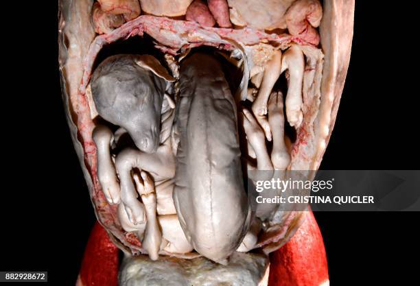 Detail of a full plastinated body of a pregnant goat with three kids inside is on display at the 'Casino de la Exposicion' cultural center in Seville...