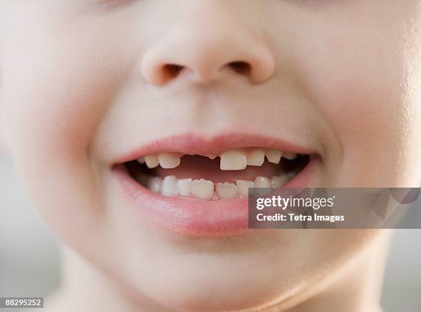 portrait of boy with missing teeth - tothless boys stock-fotos und bilder