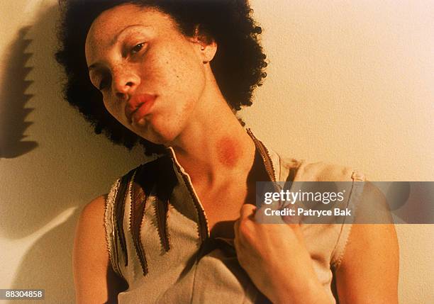 woman with hickey on neck - love bite stock pictures, royalty-free photos & images