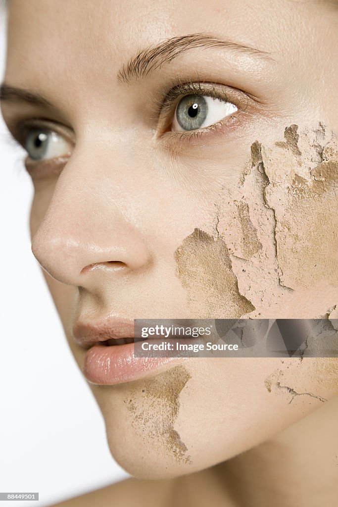 Woman with cracked and peeling skin