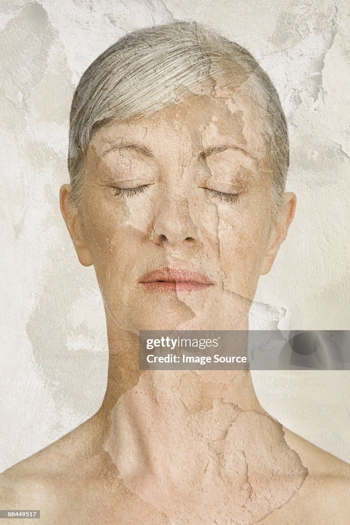 Woman with cracked and peeling skin