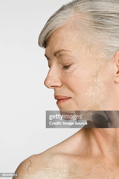 woman with cracked and peeling skin - dry skin stock-fotos und bilder