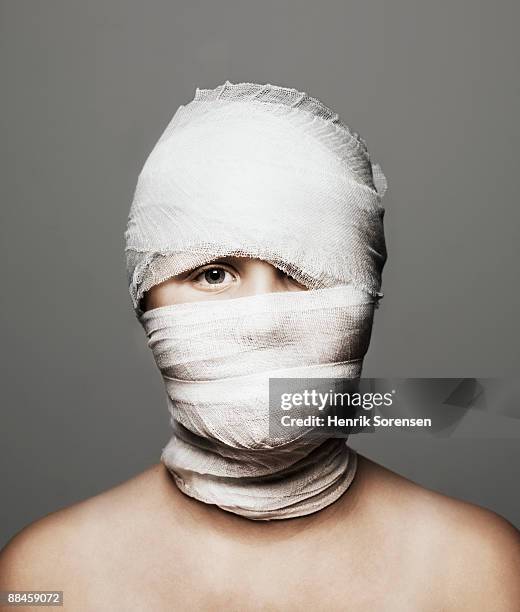 little girl with her head all wrapped in  - head bandage stock-fotos und bilder