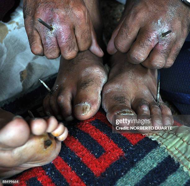 Members of the social movement "Sin Techo" show the nails they drove into their hands and feet 38 days ago in demand of the liberatation of funds to...