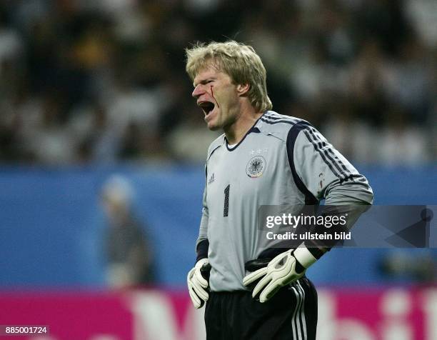 Oliver Kahn Torhüter Nationalmannschaft D: mit blutender Verletzung unter dem Auge