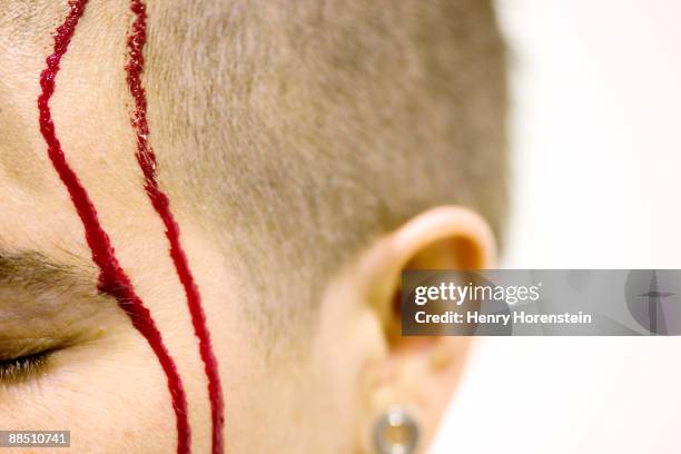 woman with head injury - head injury ストックフォトと画像