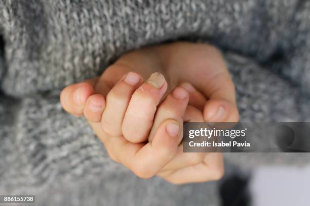 little hands with broken nail on middle finger - kid middle finger imagens e fotografias de stock